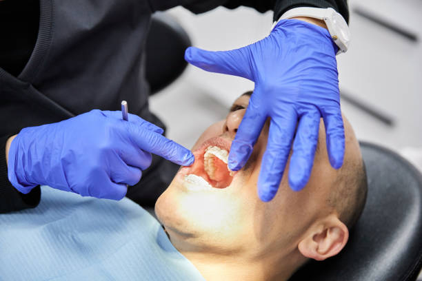 Best Emergency Tooth Extraction in Carbondale, KS